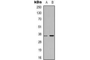 Western blot analysis of ZNF265 expression in HepG2 (A), MCF7 (B) whole cell lysates. (ZNF265 anticorps)