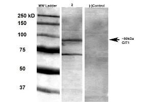 Western Blot analysis of Rat brain membrane lysate showing detection of GIT1 protein using Mouse Anti-GIT1 Monoclonal Antibody, Clone S39B-8 . (GIT1 anticorps  (AA 375-770) (Atto 488))