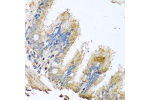 Immunohistochemistry of paraffin-embedded human trachea using COX6B1 antibody at dilution of 1:100 (x40 lens). (COX6B1 anticorps)