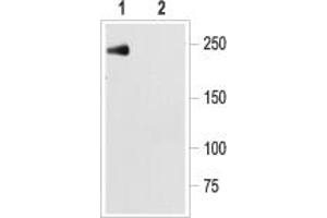 Western blot analysis of NaV1.