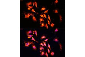 Immunofluorescence analysis of U-2 OS cells using L Polyclonal Antibody (ABIN6133274, ABIN6143083, ABIN6143084 and ABIN6215309) at dilution of 1:100 (40x lens). (LAMTOR1 anticorps  (AA 1-161))