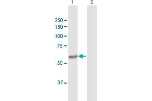 Western Blot analysis of CYP4V2 expression in transfected 293T cell line by CYP4V2 MaxPab polyclonal antibody.