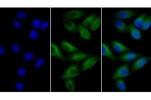 Detection of TUBb in Human MCF7 cell using Anti-Tubulin Beta (TUBb) Monoclonal Antibody