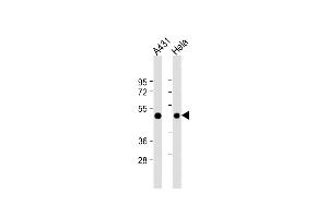 All lanes : Anti-RAD9 Antibody (BH3 Domain Specific) at 1:4000 dilution Lane 1: A431 whole cell lysate Lane 2: Hela whole cell lysate Lysates/proteins at 20 μg per lane. (RAD9A anticorps  (AA 1-30))