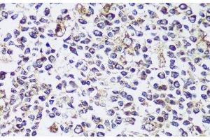 Immunohistochemistry of paraffin-embedded Human tonsil using ECH1 Polyclonal Antibody at dilution of 1:150 (40x lens). (ECH1 anticorps)