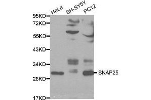 Western blot analysis of extracts of various cell lines, using SNAP25 antibody. (SNAP25 anticorps  (AA 1-206))