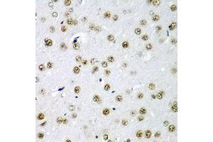 Immunohistochemistry of paraffin-embedded rat brain using SF3B3 antibody at dilution of 1:200 (40x lens). (SF3B3 anticorps)