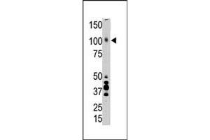 The LRP8 polyclonal antibody  is used in Western blot to detect LRP8 in placenta tissue lysate. (LRP8 anticorps  (AA 934-963))