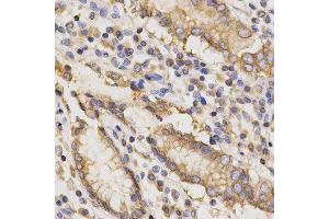 Immunohistochemistry (IHC) image for anti-TAP Binding Protein (Tapasin) (TAPBP) antibody (ABIN1875423) (TAPBP anticorps)