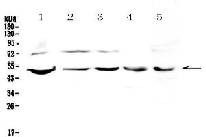 Western blot analysis of ESRRG using anti-ESRRG antibody . (ESRRG anticorps  (AA 302-458))