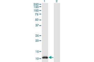 Western Blot analysis of NDUFA5 expression in transfected 293T cell line by NDUFA5 monoclonal antibody (M02), clone 4A2.
