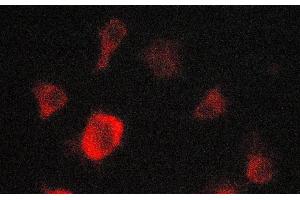 ABIN6269182 staining A549 cells by ICC/IF. (EPOR anticorps)