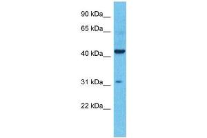Host:  Rabbit  Target Name:  KCNK4  Sample Type:  Colorectal Tumor lysates  Antibody Dilution:  1. (KCNK4 anticorps  (N-Term))