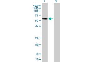 Western Blot analysis of PNLIPRP2 expression in transfected 293T cell line by PNLIPRP2 MaxPab polyclonal antibody. (PNLIPRP2 anticorps  (AA 1-469))