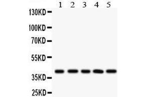 Anti- HLA-C Picoband antibody, Western blotting All lanes: Anti HLA-C  at 0.