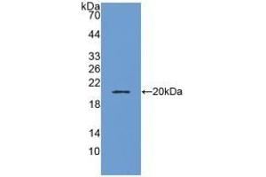 Detection of Recombinant ADM, Human using Polyclonal Antibody to Adrenomedullin (ADM) (Adrenomedullin anticorps  (AA 22-147))
