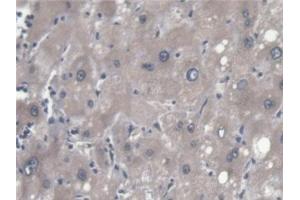 Detection of ERLIN2 in Human Liver Tissue using Polyclonal Antibody to Endoplasmic Reticulum Lipid Raft Associated Protein 2 (ERLIN2)