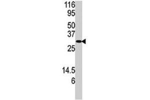 Western blot analysis of DUSP3 polyclonal antibody  in SK-BR-3 cell lysate. (Dual Specificity Phosphatase 3 (DUSP3) (N-Term) anticorps)