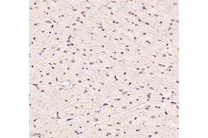Immunohistochemistry of paraffin embedded rat heart using USP24 (ABIN7076111) at dilution of 1:1000 (400x lens)