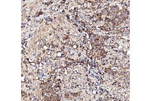 IHC analysis of BCKDHA using anti-BCKDHA antibody (ABIN7601223).