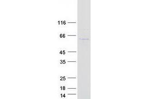 Validation with Western Blot