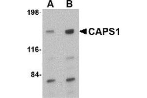 Western Blotting (WB) image for anti-Ca++-Dependent Secretion Activator (CADPS) (C-Term) antibody (ABIN1030309)
