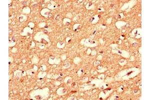Immunohistochemistry of paraffin-embedded human brain tissue using ABIN7148421 at dilution of 1:100