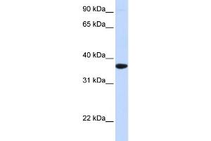WB Suggested Anti-SCGN Antibody Titration:  0. (SCGN anticorps  (Middle Region))