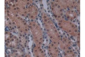 Detection of GKRP in Mouse Kidney Tissue using Polyclonal Antibody to Glucokinase Regulatory Protein (GKRP)
