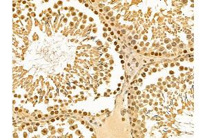 ABIN6262398 and ABIN6269012 at 1/100 staining Rat testis tissue by IHC-P. (HSP70 1A anticorps  (C-Term))