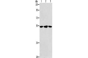 Gel: 8 % SDS-PAGE, Lysate: 40 μg, Lane 1-3: Human fetal liver tissue, hela cells, Human fetal brain tissue, Primary antibody: ABIN7189774(ALDH9A1 Antibody) at dilution 1/240, Secondary antibody: Goat anti rabbit IgG at 1/8000 dilution, Exposure time: 30 seconds (ALDH9A1 anticorps)
