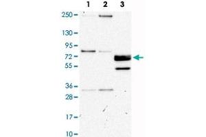 Western Blot analysis of Lane 1: RT-4, Lane 2: U-251MG sp and Lane 3: human plasma (IgG/HSA depleted) with CUX1 polyclonal antibody . (CUX1 anticorps)