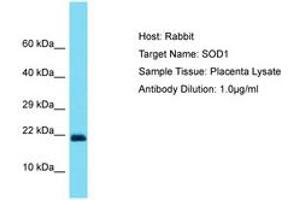 Image no. 1 for anti-Superoxide Dismutase 1, Soluble (SOD1) (C-Term) antibody (ABIN6750454) (SOD1 anticorps  (C-Term))