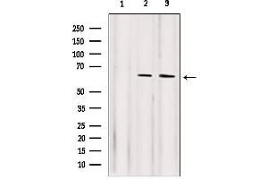 Western blot analysis of extracts from various samples, using NF-kappaB p65 Antibody.