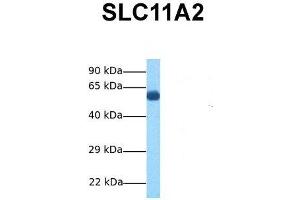 Host:  Rabbit  Target Name:  SLC11A2  Sample Tissue:  Human Fetal Lung  Antibody Dilution:  1. (SLC11A2 anticorps  (N-Term))