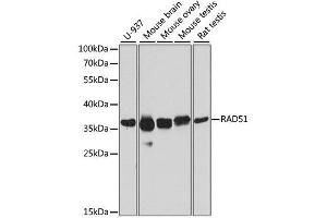 Western blot analysis of extracts of various cell lines, using RAD51 antibody. (RAD51 anticorps  (AA 50-150))