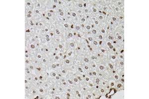 Immunohistochemistry of paraffin-embedded mouse liver using KDM4A antibody (ABIN5975678) at dilution of 1/100 (40x lens). (KDM4A anticorps)