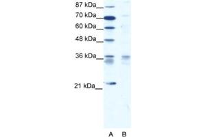 Western Blotting (WB) image for anti-BARX Homeobox 1 (BARX1) antibody (ABIN2460616) (BARX1 anticorps)
