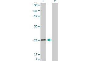 Western Blot analysis of TNNI3 expression in transfected 293T cell line by TNNI3 monoclonal antibody (M04), clone 1E7. (TNNI3 anticorps  (AA 102-210))