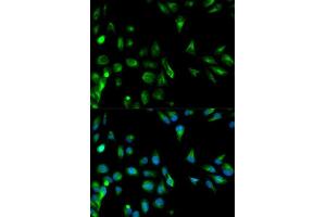 Immunofluorescence analysis of HeLa cell using RASSF1 antibody. (RASSF1 anticorps  (AA 101-340))