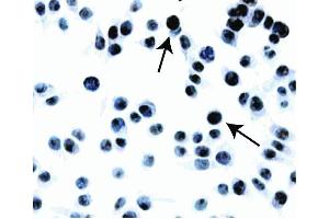 Immunohistochemical staining of MGMT. (MGMT anticorps)
