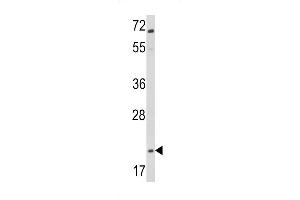 Western blot analysis of Glucagon Antibody (C-term) (ABIN390769 and ABIN2841027) in Jurkat cell line lysates (35 μg/lane).