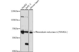 Western blot analysis of extracts of various cell lines, using Thioredoxin reductase 1 (Thioredoxin reductase 1 (TXNRD1 ) ) antibody (ABIN7270806) at 1:1000 dilution. (TXNRD1 anticorps)