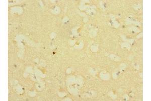 Immunohistochemistry of paraffin-embedded human brain tissue using ABIN7156544 at dilution of 1:100