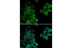 Immunofluorescence analysis of HeLa cells using PSMB10 antibody (ABIN6132527, ABIN6146311, ABIN6146312 and ABIN6221107). (PSMB10 anticorps  (AA 1-273))