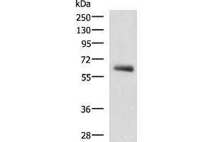 Western blot analysis of Human metastatic papillary carcinoma(thyroid cancer) tissue lysate using KBTBD11 Polyclonal Antibody at dilution of 1:2300 (KBTBD11 anticorps)