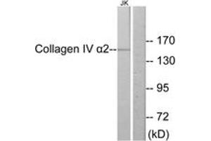 Western Blotting (WB) image for anti-Collagen, Type IV, alpha 2 (COL4A2) (AA 151-200) antibody (ABIN2889911) (COL4a2 anticorps  (AA 151-200))