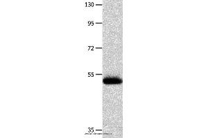 Western blot analysis of Human endometrial carcinoma tissue  , using MMP10 Polyclonal Antibody at dilution of 1:200 (MMP10 anticorps)