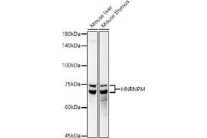 Western blot analysis of extracts of various cell lines, using HNRNPM antibody (ABIN7267635) at 1:1000 dilution.