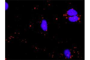 Proximity Ligation Analysis of protein-protein interactions between ATF4 and CREBBP.